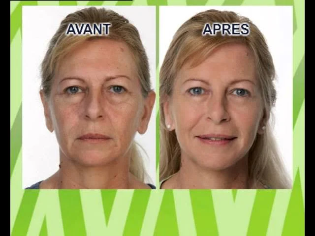 Jeunesse mysterieuse X2 – Image 8